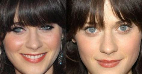 zooey deschanel filler|Zooey Deschanels Plastic Surgery: Nose Job, Lip。